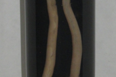 P. equorum - dospelce (makropreparát)