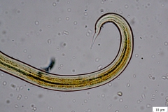 Protostrongylus spp. - larva prvého štádia (chvost - detail)