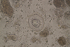 Raillietina spp. - vajíčko