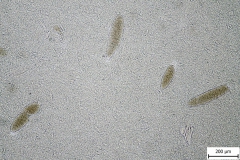 Sarcocystis sp. - svalové cysty v MH (tráviaca metóda)