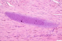 Sarcocystis sp. - svalová cysta v MH (histologický rez  - detail)