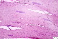 Sarcocystis sp. - svalové cysty v MH (histologický rez )