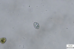 Sarcocystis sp. - uvoľnená sporocysta v truse DH