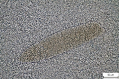 Sarcocystis sp. - svalové cysty v MH (tráviaca metóda - detail)