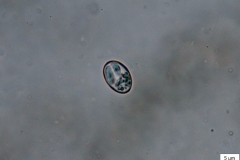 Sarcocystis sp. - uvoľnená sporocysta v truse DH (detail)