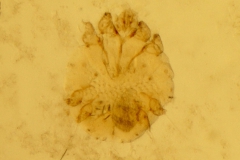 S. scabiei var. suis