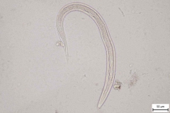 S. stercoralis - larva prvého štádia (orig foto: Dr. G. Štrkolcová)