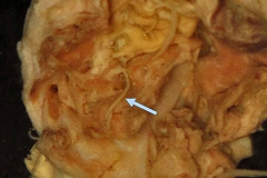 S. vulgaris - larva štvrtého štádia (trvalý makropreparát)