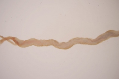 S. trachea - dospelce, pár (trvalý mikropreparát)