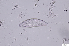 S. obvelata - vajíčko