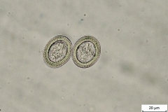 Taenia spp. - vajíčka