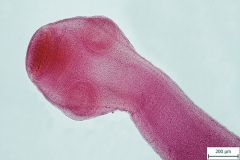 T. hydatigena - scolex