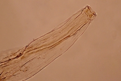 T. callipeda - hlavová časť dospelého jedinca