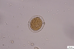 T. vitulorum - vajíčko (trvalý mikropreparát)
