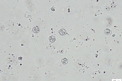 Nevysporulované a vysporulované oocysty T. gondii