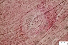 T. spiralis - detail