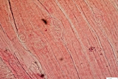 T. spiralis