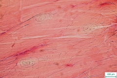 T. spiralis