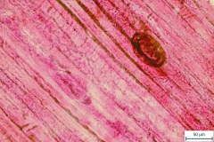 T. pseudospiralis