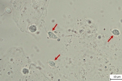 T. gallinae - natívny preparát (detail)